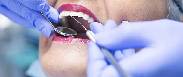 Best Emergency Dentist for Lost Fillings or Crowns in Smethport, PA